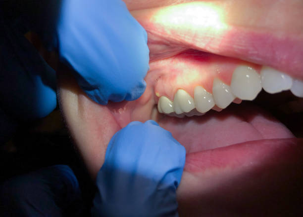 Best Emergency Gum Pain Relief  in Seward, AK